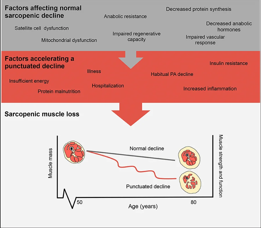 sarcopenia-causation
